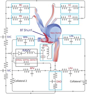 Reproducing Patient-Specific Hemodynamics in the Blalock–Taussig Circulation Using a Flexible Multi-Domain Simulation Framework: Applications for Optimal Shunt Design